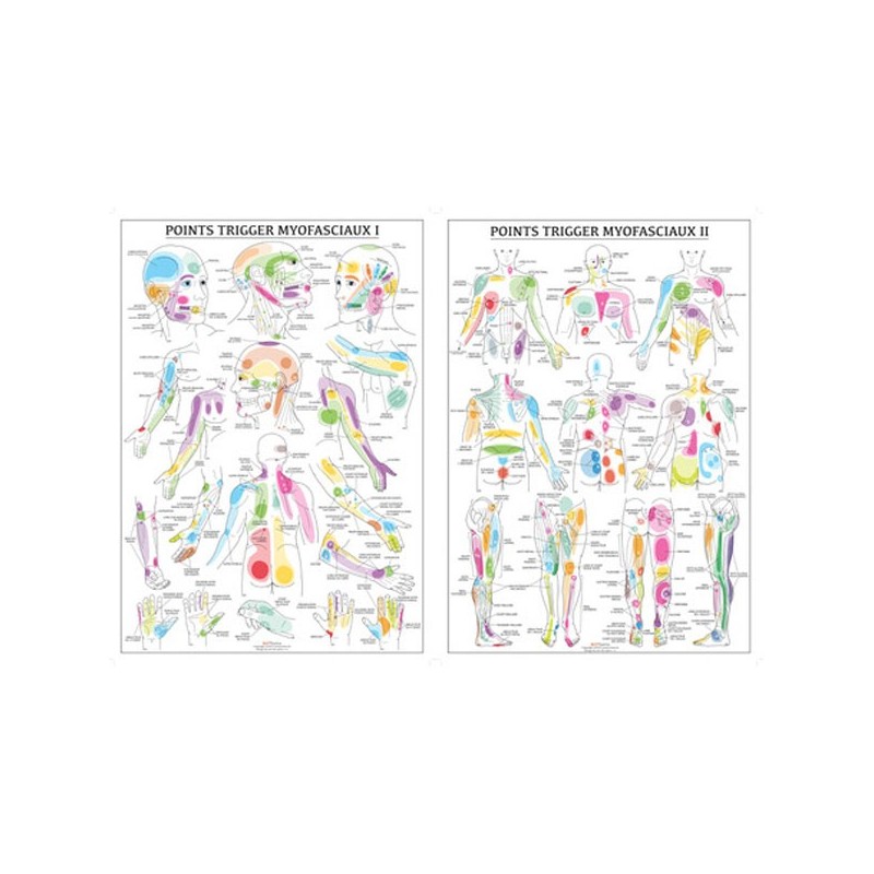 Planches Anatomiques Points Trigger Myofasciaux - Dry needling - SISSEL Pro Planches Anatomiques Points Trigger Myofasciaux - Dry needling - SISSEL Pro