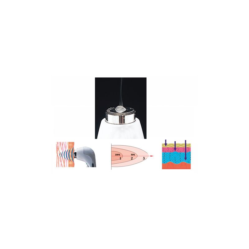 Appareil à ultrasons MINISONIC® Winelec® - Ultrasons - Matériel kiné - SISSEL Pro Appareil à ultrasons MINISONIC® Winelec® - Ultrasons - Matériel kiné - SISSEL Pro