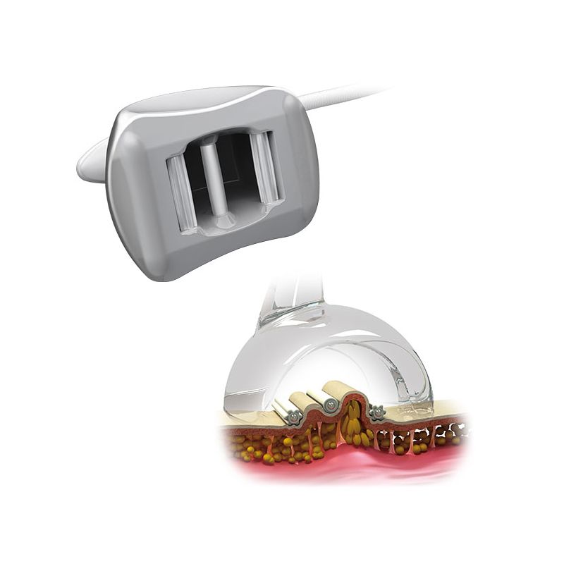 DXFOCUS Stretching cellulaire® EVO 3D - SISSEL Pro