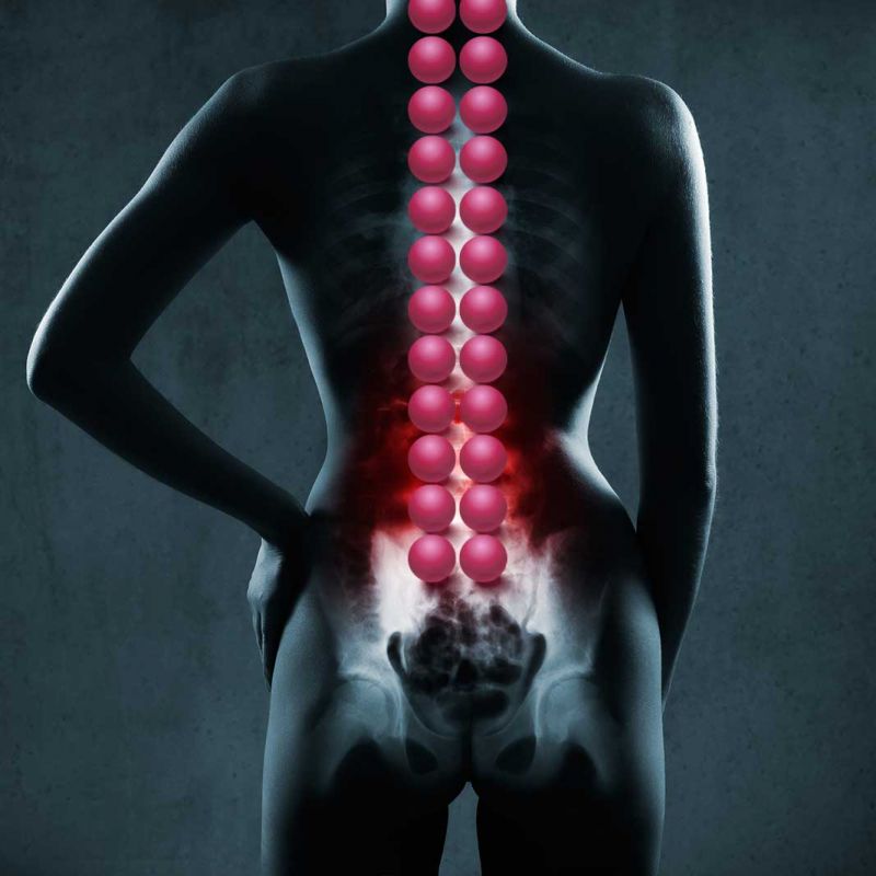 Les bienfaits du SISSEL® Spinefit sur la colonne vertebrale Les bienfaits du SISSEL® Spinefit sur la colonne vertebrale