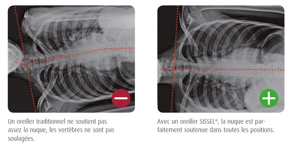 l'intérêt d'avoir un bon oreiller